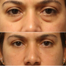 Before and after