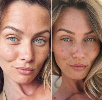 Before and after